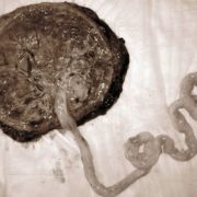 5 raisons pour lesquelles le placenta est incroyable