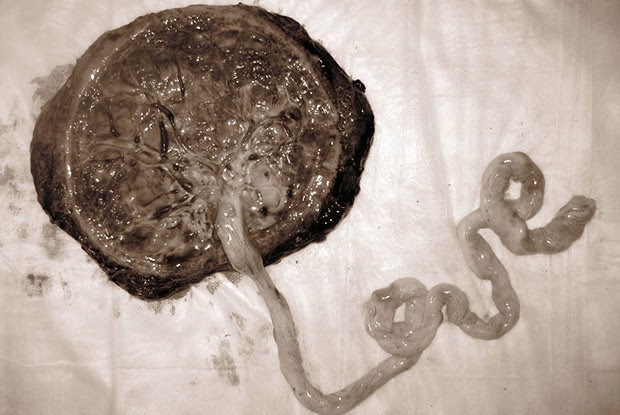 5 raisons pour lesquelles le placenta est incroyable