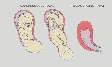 stade accouchement