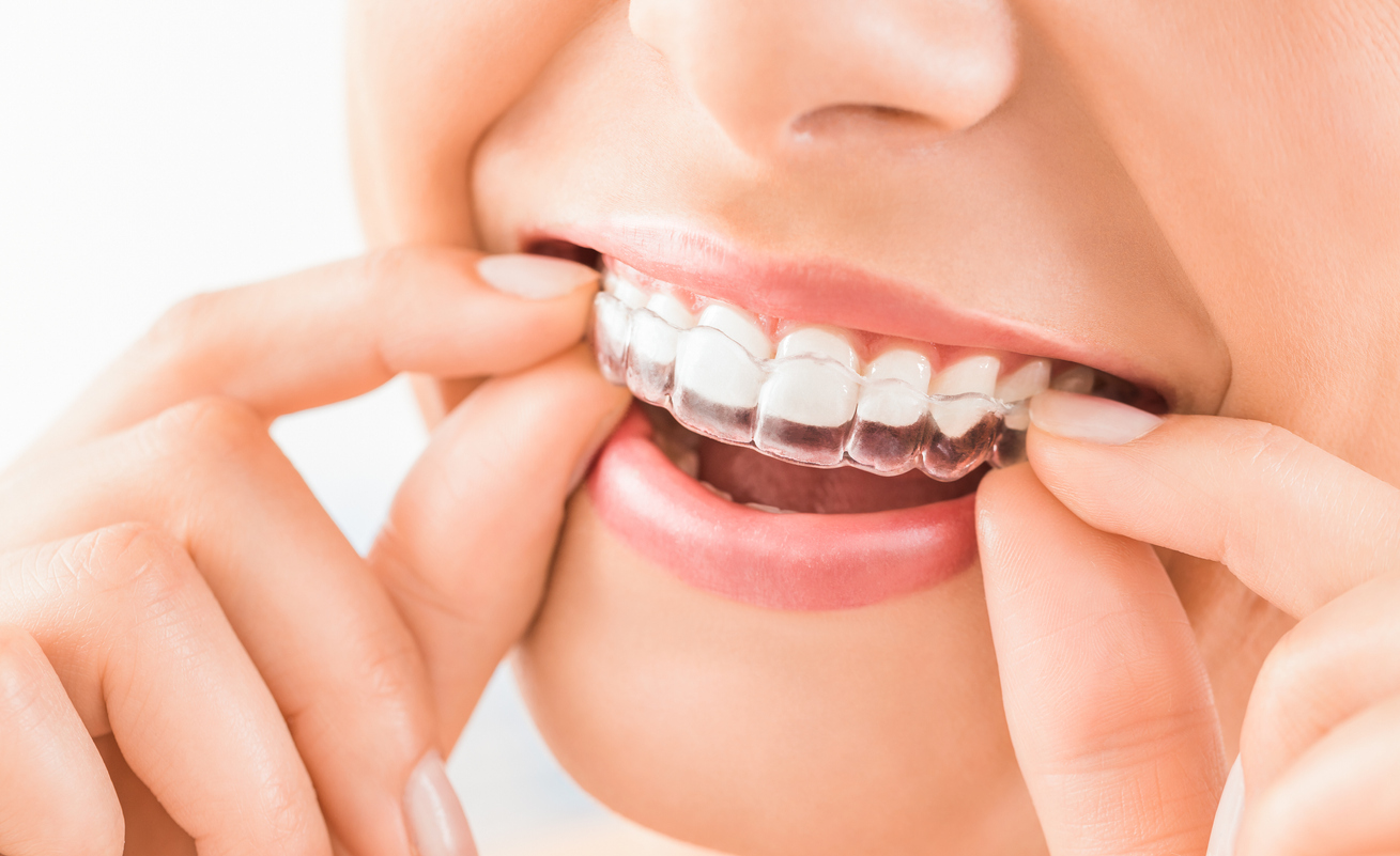 Beau sourire et des dents blanches d’une jeune femme